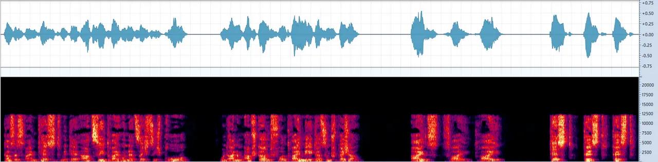 RC360 Quick Start - 1A Audio Qualität